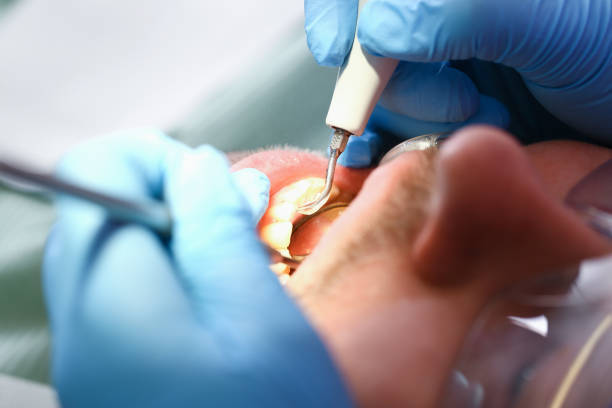 Best Emergency Gum Treatment in Dayton, VA