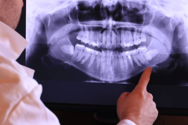 Best Emergency Tooth Extraction in Dayton, VA