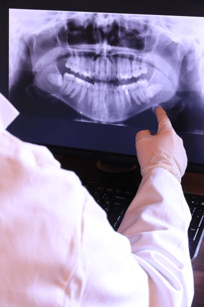 Best Emergency Dental Care for Broken or Chipped Teeth in Dayton, VA